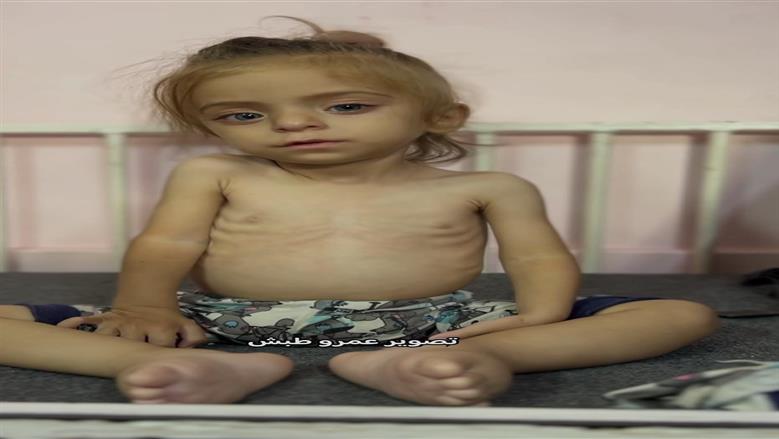 الطفلة سيلين