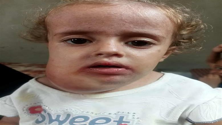 ..