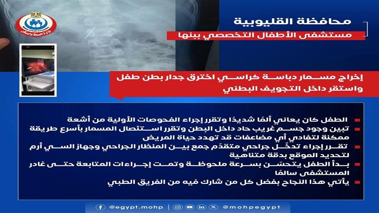 مستشفي اطفال بنها التخصصي 