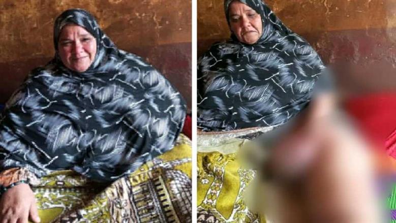 «الحاجة عايدة» سجينة في جحيم داء الفيل منذ 15 سنة بالشرقية.. وتستغيث لعلاجها