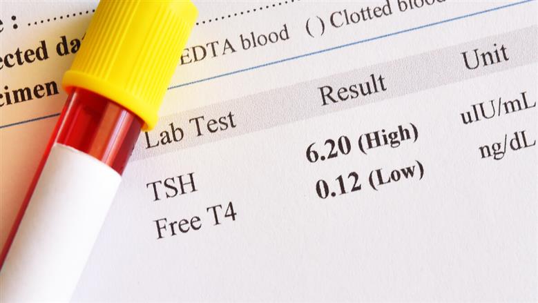 أسعار تحليل الغدة الدرقية في المراكز الطبية.. ونصائح مهمة قبل إجرائه