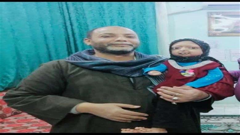 وفاة «آلاء» طفلة الشيخوخة المبكرة في قنا.. واجهت المرض بحفظ القرآن