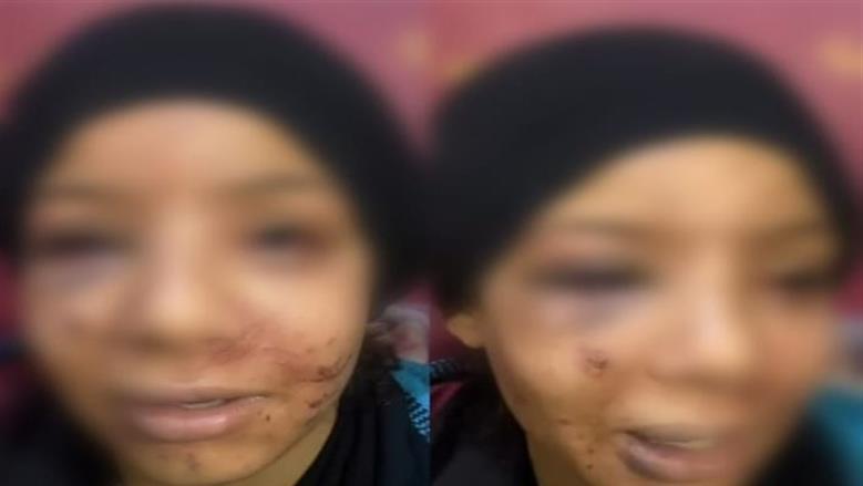أرض زراعية ومحاولة لخلع عينيها.. القصة الكاملة للاعتداء على طفلة بلبيس