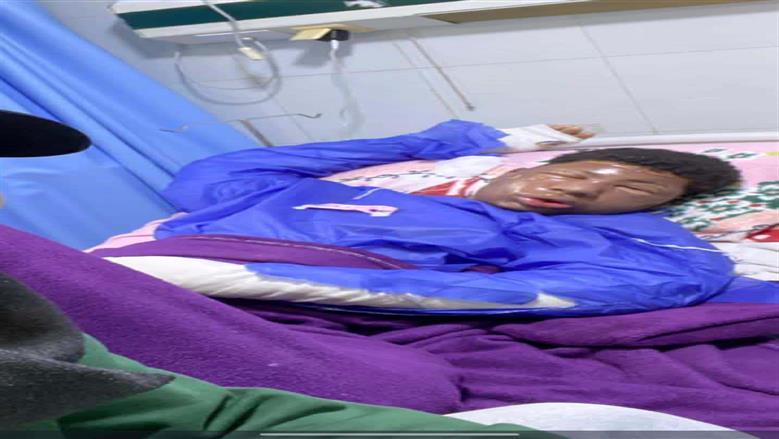 ضحية لقمة العيش.. طالب جامعي يصاب بحروق بالغة إثر حريق داخل مخبز بالشرقية: بيصرف على أهله