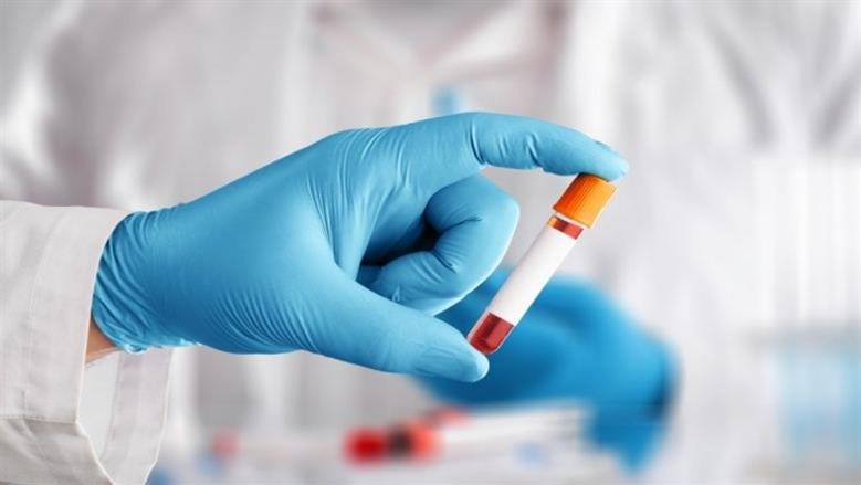 أسعار تحليل وظائف الكلى 2026..نصائح مهمة قبل الفحص