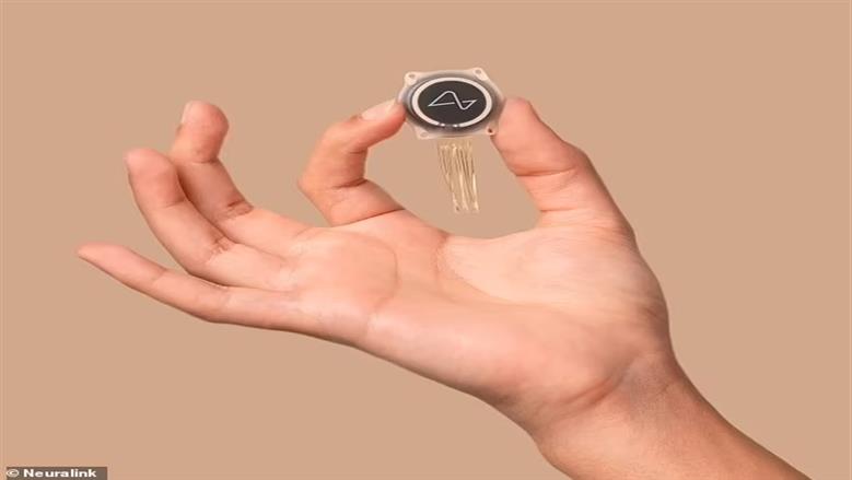 شريحة إيلون ماسك