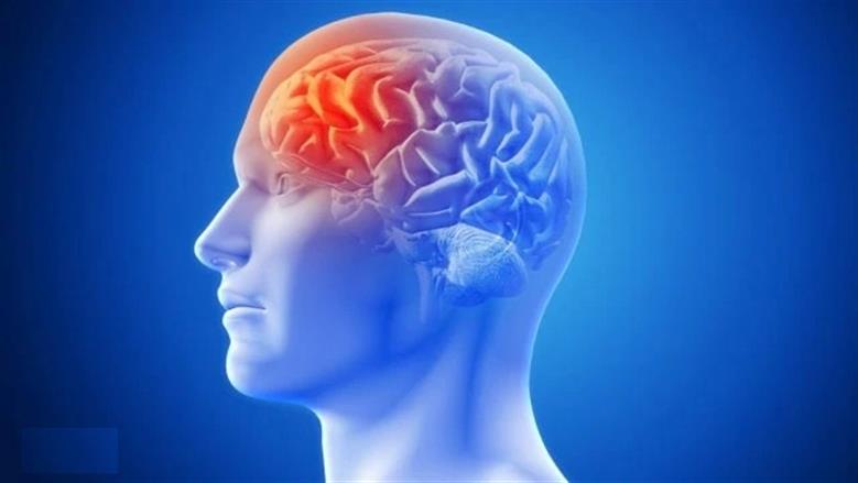 ما الاضطراب العصبي الوظيفي وأعراضه؟.. أكثر شيوعا بين النساء