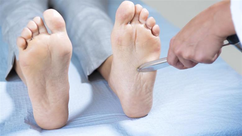 اعتلال عصبي محيطي محوري