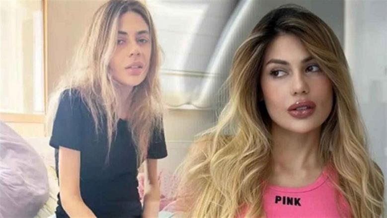  أودى بحياة شابة تركية.. ما هو مرض فقدان الشهية العصبي؟