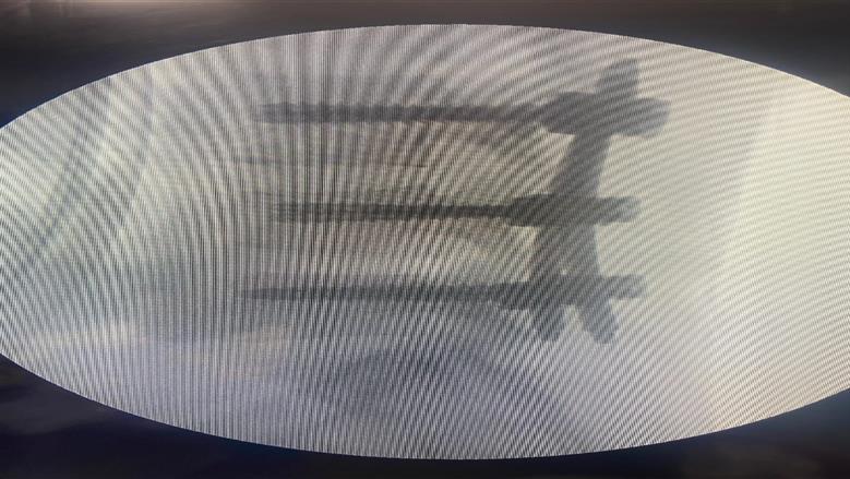 جراحة بنها الجامعي 
