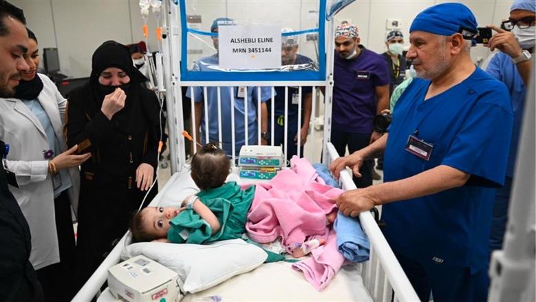 التوأم الملتصق السوري