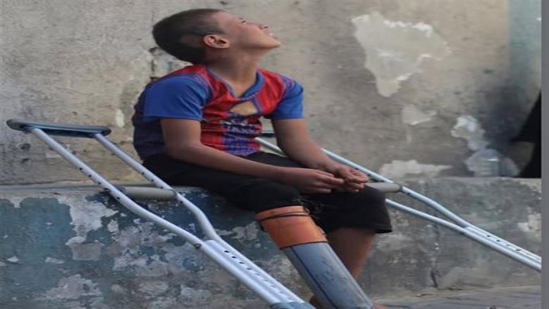«وجع الدنيا كله».. طفل فلسطيني يستخدم ماسورة بلاستيك بدلا من الساق الصناعية
