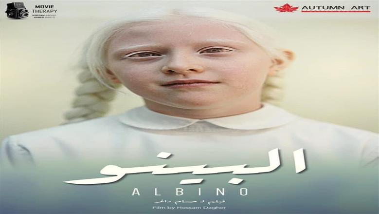 «يرصد معاناة أعداء الشمس».. حسام داغر يشارك في مهرجان مانشيستر بفيلم «البينو»