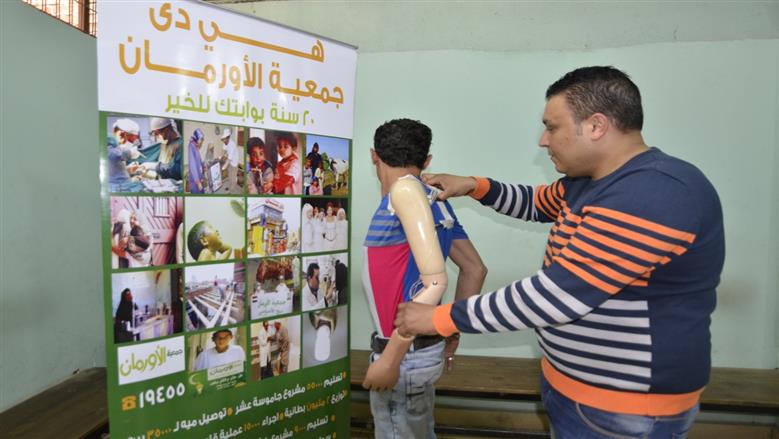 تركيب أطراف صناعية بالمنوفية