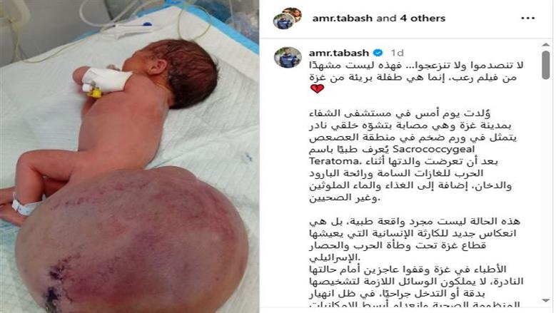 طفلة فلسطينة 