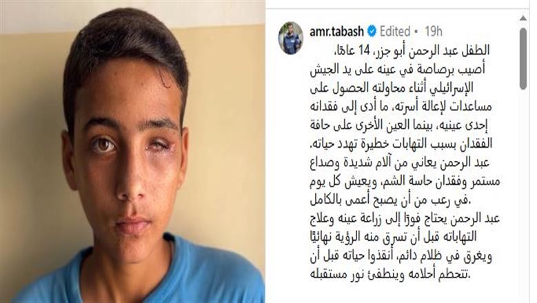 الطفل عبد الرحمن 
