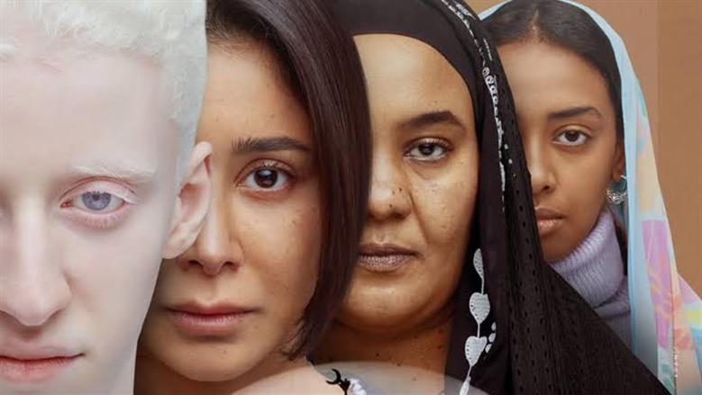 بعد طرح مشكلة الألبينو في فيلم «ضي».. كل ما تريد معرفته عن المرض نفسيا وجسديا