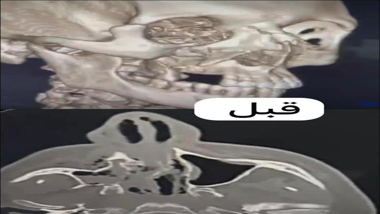 صحة الدقهلية