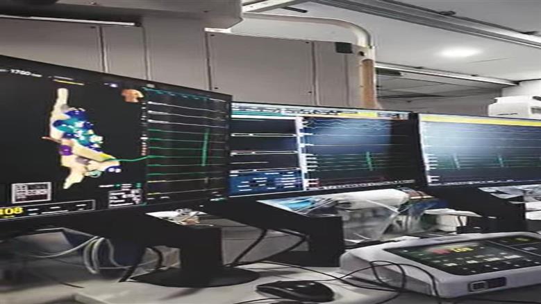 نجاح إجراء تدخل طبي دقيق بتقتية “كيّ العقد العصبية بمستشفى النصر التخصصي ببورسعيد