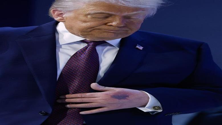 ا