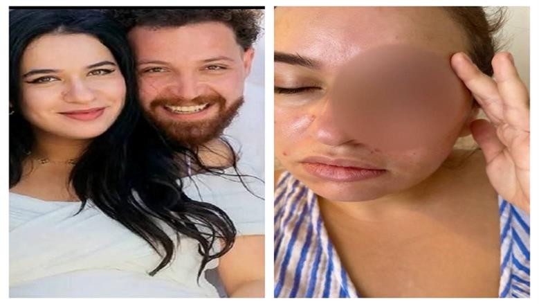 «عايزة تاخد ابني».. القصة الكاملة لأزمة اعتداء الفنان محمود حجازي على زوجته