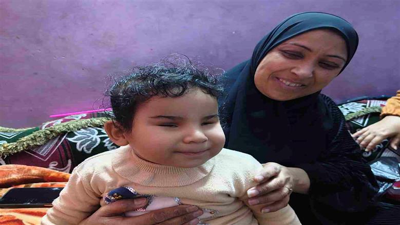 ولدت دون عيون.. «سجدة» طفلة الـ 3 سنوات تتحسس الدنيا بقلبها وتحلم بالإبصار من جديد