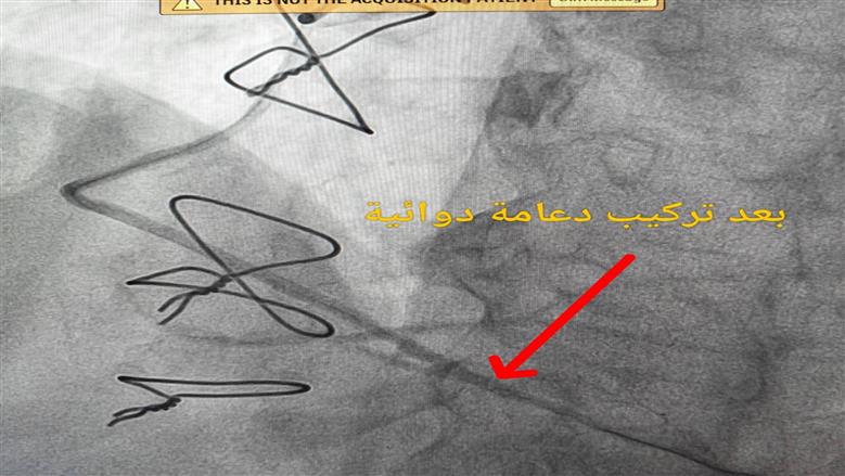 مستشفى أشمون