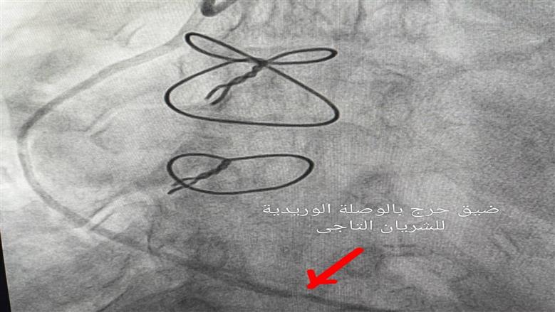 مستشفى أشمون