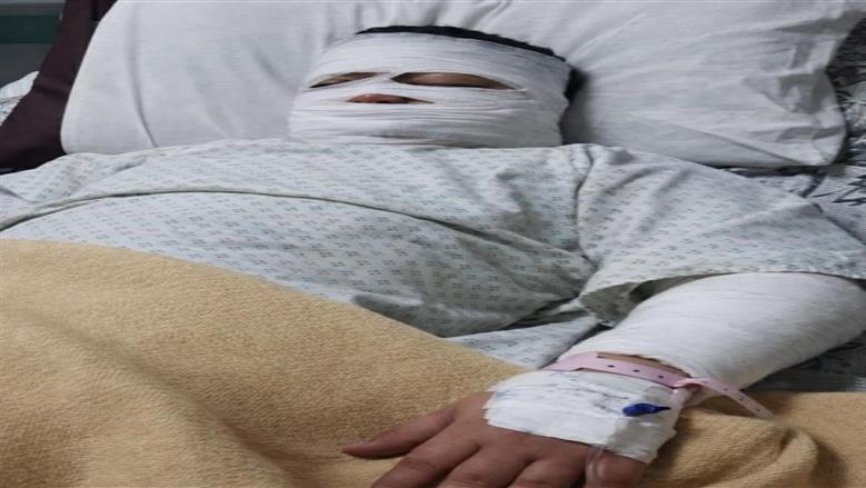 تفاصيل إصابة شاب بزيت مغلي بالقليوبية ... يرقد في العناية المركزة ويحتاج الدعاء 