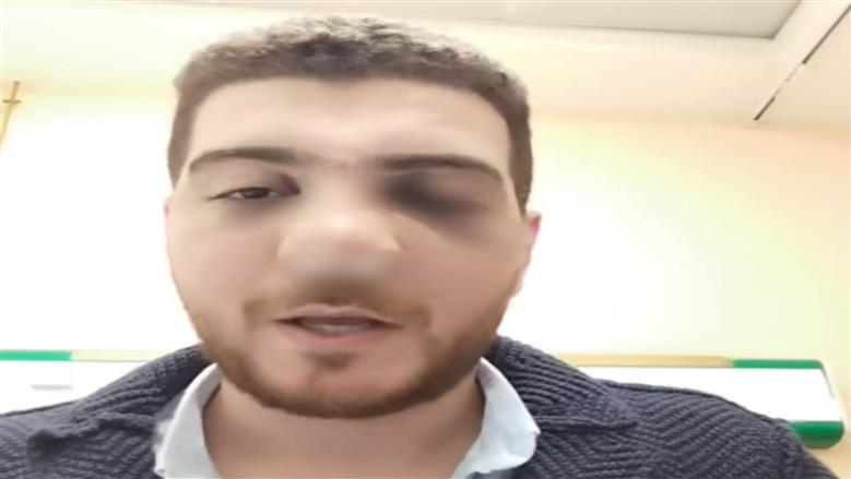 كسر في الأنف.. تفاصيل اعتداء مرافق مريض على طبيب بمستشفى الباجور بالمنوفية