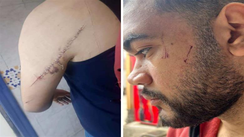 بعد 3 أشهر من زواجهما.. عروس تعتدي على زوجها في الشرقية بسبب «كوب عصير»