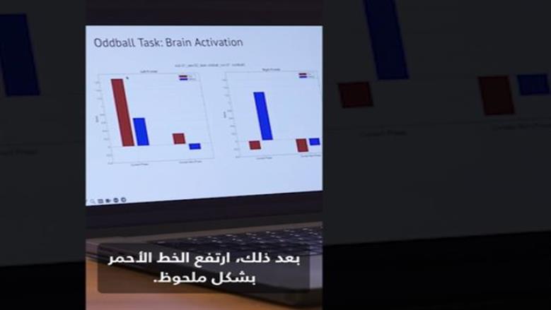 الدماغ