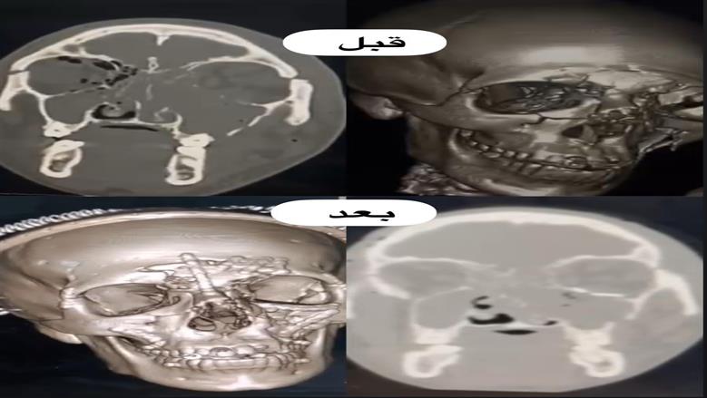 صحة الدقهلية