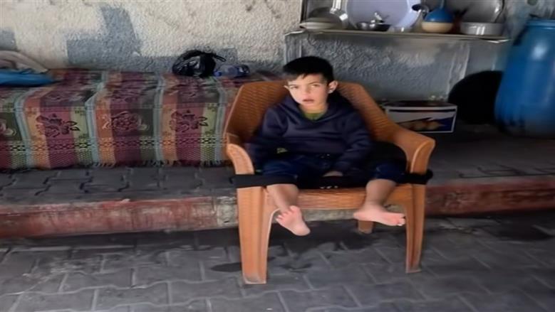  حرب غزة تصيب الطفل أمير بنوبات تشنج كهربائي وشلل دماغي.. «الحبال وسيلة السيطرة عليه»