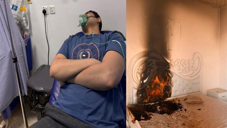 انفجار «باور بانك» يحول غرفة «محمد» إلى جحيم.. نجا من الموت بأعجوبة (فيديو)