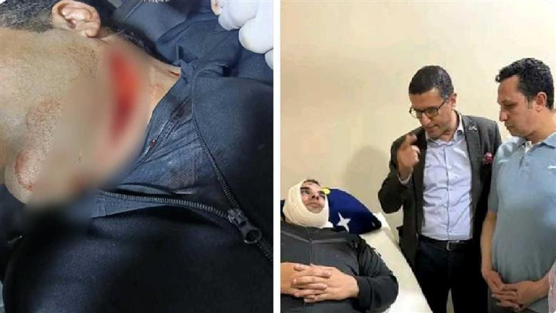 مدير مركز شباب أبو حماد يكشف تفاصيل الاعتداء عليه داخل مقر عمله