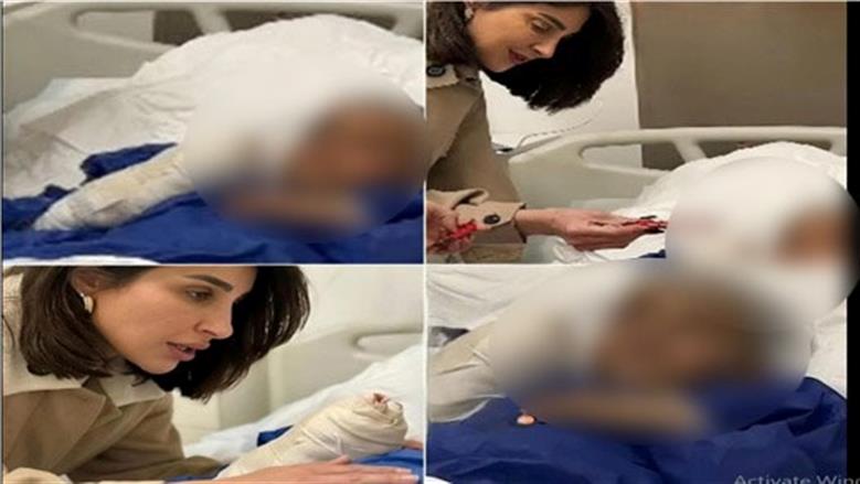 عاقبته والدته بالماء المغلي.. الطفل مالك ضحية العنف الأسري يخضع لجلسات دعم نفسي