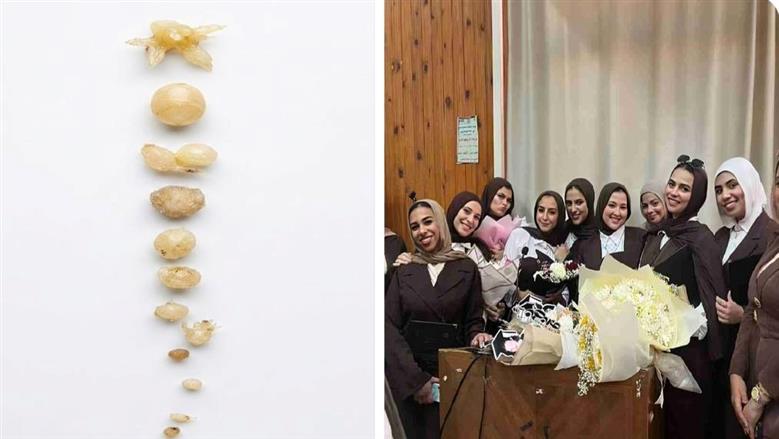 بالأسماء.. طالبات بـ «زراعة الزقازيق» ينجحن في إنتاج 3 أصناف من البطاطس الخالية من الفيروسات