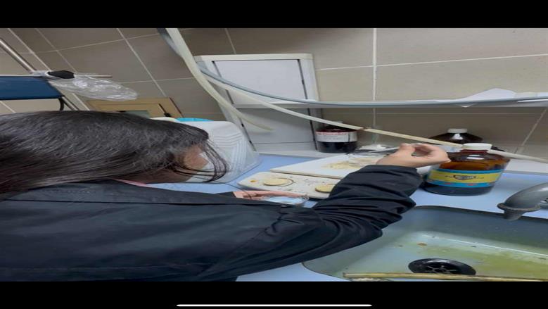 طالبات بجامعة الزقازيق يبتكرن مشروعًا باستخدام الجسيمات النانوية لمكافحة سرطان الرئة وتنظيم الإجهاد التأكسدي