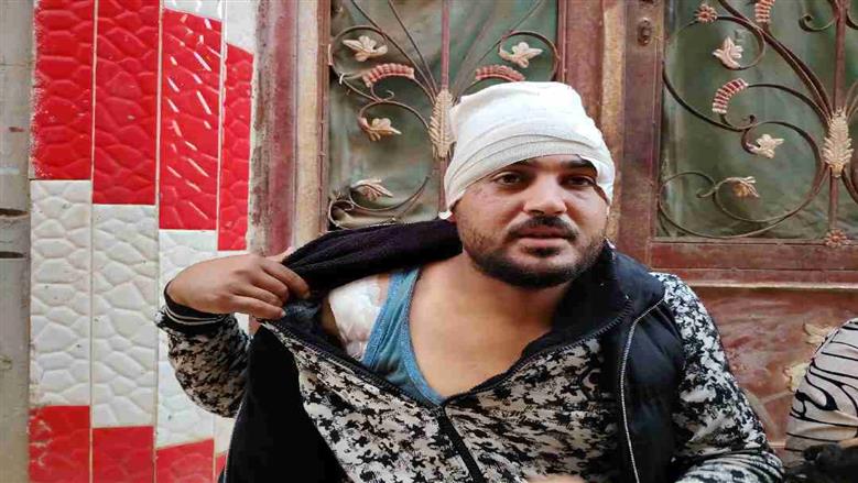إصابة سائق بـ112 غرزة بعد الاعتداء عليه بأسلحة بيضاء في الشرقية
