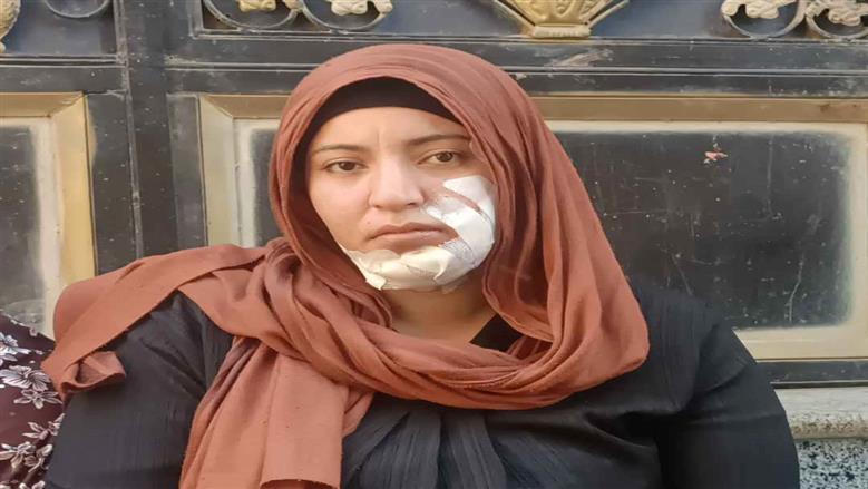 ضبط شاب وفتاة في الشرقية لاتهامهما بإصابة سيدة بجرح طعني