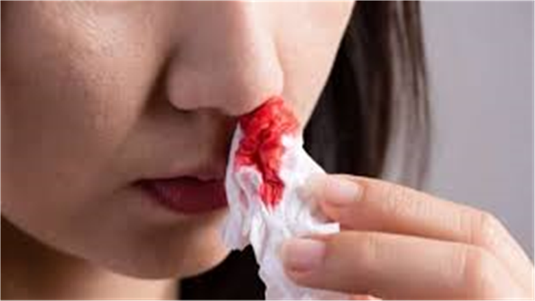 لا تتجاهله أبداً.. متى يكون نزيف الأنف رسالة تحذيرية مهمة من الجسم؟