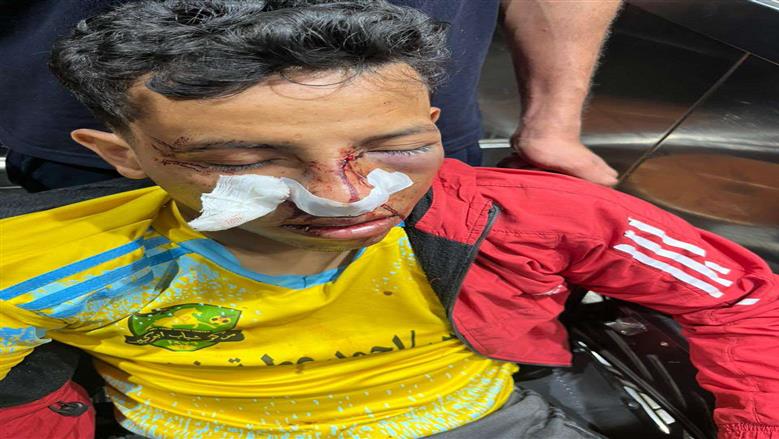 بلاغ يتهم 4 أشخاص بالتعدي على لاعب كرة قدم وإصابته في الشرقية