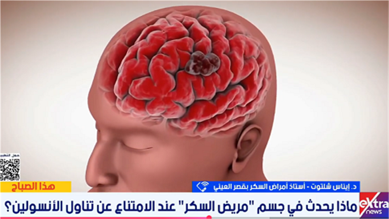 ماذا يحدث في جسم مريض السكر عند الامتناع عن تناول الأنسولين؟.. طبيبة تحذر من المخاطر