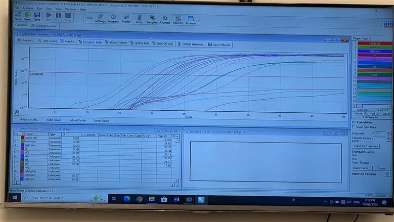 تشغيل وحدة PCR بمركز أورام طنطا لخدمة مرضى اللوكيميا مجانًا