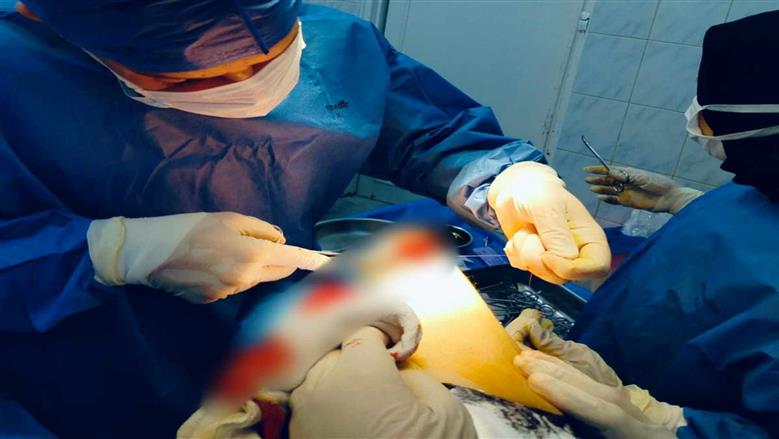 نجاح استئصال ورم دموي بالذراع لمريضة بمستشفى مشتول السوق المركزي
