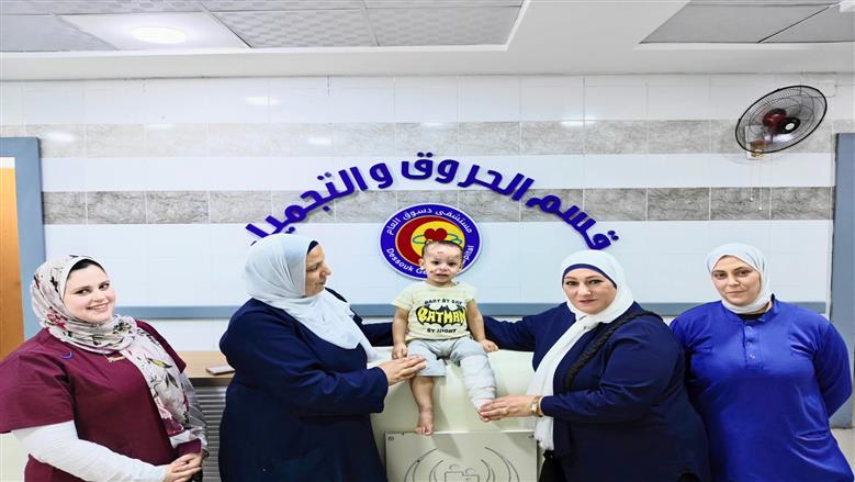 فريق طبي بـ«دسوق العام» ينجح في إنقاذ طفل من حروق خطيرة بنسبة 20%