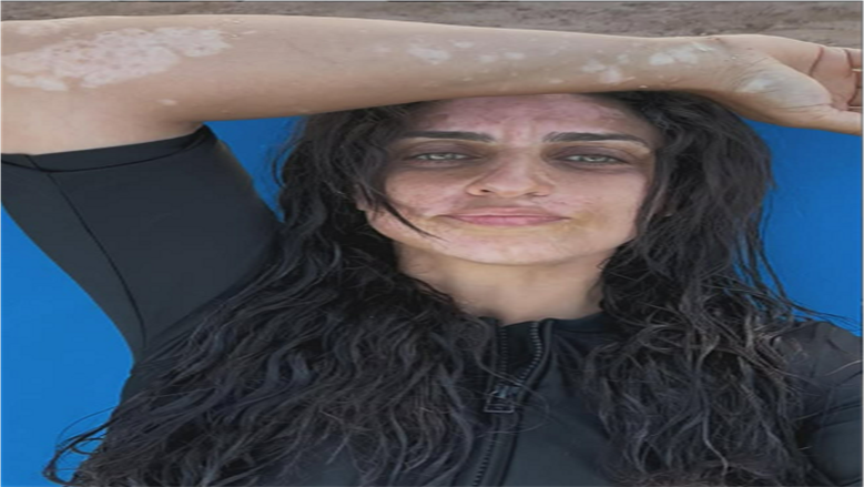 أمير كرارة يوجه رسالة لشقيقته بعد إعلان إصابتها بالبهاق: «هو أنتي فيه في حلاوتك»