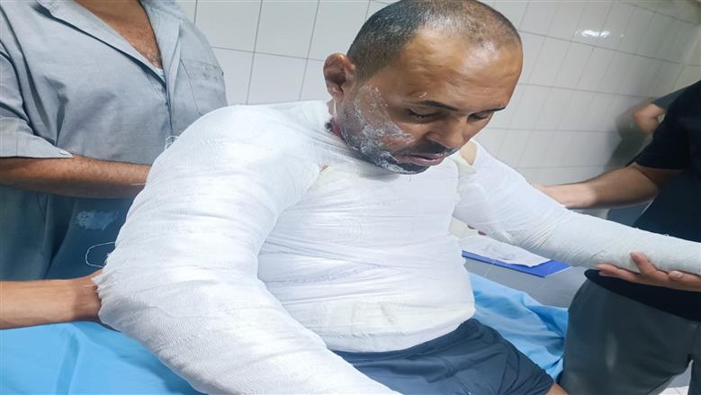 «بسبب معاكسة سيدة».. حبس متهم بإشعال النيران في صاحب محل دواجن بالشرقية