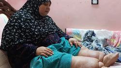 «حنان» حياتها متوقفة بسبب السمنة ومرض الفيل: «مش عايزة أبقى عبء على حد»